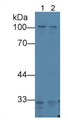 Western Blot; Sample: Lane1: Human Liver lysate; Lane2: Human Lung lysate; Primary Ab: 2µg/mL Rabbit Anti-Human PKN2 Antibody; Second Ab: 0.2µg/mL HRP-Linked Caprine Anti-Rabbit IgG Polyclonal Antibody;