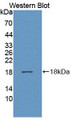 Western Blot; Sample: Recombinant protein. Western Blot; Sample: Recombinant protein.
