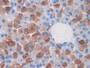 DAB staining on IHC-P; Samples: Mouse Liver Tissue;  Primary Ab: 10µg/ml Rabbit Anti-Mouse CAPN1 Ant