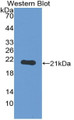 Western Blot; Sample: Recombinant protein. Western Blot; Sample: Recombinant protein.