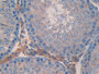 DAB staining on fromalin fixed paraffin- embedded stomach tissue) DAB staining on fromalin fixed paraffin- embedded stomach tissue)