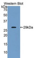 Western Blot; Sample: Recombinant protein. Western Blot; Sample: Recombinant protein.