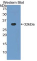 Western Blot; Sample: Recombinant protein. Western Blot; Sample: Recombinant protein.