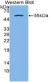 Western Blot; Sample: Recombinant protein. Western Blot; Sample: Recombinant protein.