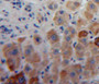 Used in DAB staining on fromalin fixed paraffin-embedded liver tissue Used in DAB staining on fromalin fixed paraffin-embedded liver tissue