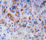 Used in DAB staining on fromalin fixed paraffin-embedded Liver tissue Used in DAB staining on fromalin fixed paraffin-embedded Liver tissue