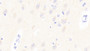 DAB staining on IHC-P; Samples: Human Cerebrum Tissue;  Primary Ab: 20μg/ml Rabbit Anti-Human GP6 Antibody Second Ab: 2µg/mL HRP-Linked Caprine Anti-Rabbit IgG Polyclonal Antibody 