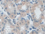 DAB staining on IHC-P; Samples: Human Stomach Tissue; Primary Ab: 20µg/ml Rabbit Anti-Human IDE Antibody Second Ab: 2µg/mL HRP-Linked Caprine Anti-Rabbit IgG Polyclonal Antibody DAB staining on IHC-P; Samples: Human Stomach Tissue; Primary Ab: 20µg/ml Rabbit Anti-Human IDE Antibody Second Ab: 2µg/mL HRP-Linked Caprine Anti-Rabbit IgG Polyclonal Antibody