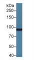 Western Blot; Sample: Rat Cerebrum lysate; Primary Ab: 1µg/ml Rabbit Anti-Human GRM3 Antibody Second Ab: 0.2µg/mL HRP-Linked Caprine Anti-Rabbit IgG Polyclonal Antibody Western Blot; Sample: Rat Cerebrum lysate; Primary Ab: 1µg/ml Rabbit Anti-Human GRM3 Antibody Second Ab: 0.2µg/mL HRP-Linked Caprine Anti-Rabbit IgG Polyclonal Antibody