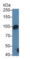 Western Blot; Sample: Mouse Kidney lysate; Primary Ab: 0.3µg/ml Rabbit Anti-Mouse ACE2 Antibody; Second Ab: 0.2µg/mL HRP-Linked Caprine Anti-Rabbit IgG Polyclonal Antibody;