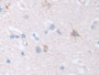 DAB staining on IHC-P; Samples: Human Cerebrum Tissue; Primary Ab: 20µg/ml Rabbit Anti-Human F8 Antibody Second Ab: 2µg/mL HRP-Linked Caprine Anti-Rabbit IgG Polyclonal Antibody