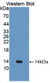 Western Blot; Sample: Recombinant protein. Western Blot; Sample: Recombinant protein.
