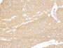 DAB staining on IHC-P; Samples: Human Cerebrum Tissue; Primary Ab: 10µg/ml Rabbit Anti-Human TUBb Antibody Second Ab: 2µg/mL HRP-Linked Caprine Anti-Rabbit IgG Polyclonal Antibody