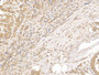 DAB staining on fromalin fixed paraffin- embedded spleen tissue)