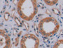 DAB staining on fromalin fixed paraffin- embedded Kidney tissue) DAB staining on fromalin fixed paraffin- embedded Kidney tissue)