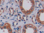 DAB staining on IHC-P; Samples: Human Kidney Tissue;  Primary Ab: 10µg/ml Rabbit Anti-Human EGFR2 An DAB staining on IHC-P; Samples: Human Kidney Tissue;  Primary Ab: 10µg/ml Rabbit Anti-Human EGFR2 An