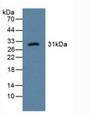Western Blot; Sample: Human Urine.