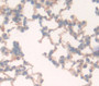 Used in DAB staining on fromalin fixed paraffin- embedded Kidney tissue