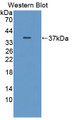 Western Blot; Sample: Recombinant VEGFR1, Mouse.