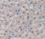 Interleukin 6 Receptor (IL6R) Polyclonal Antibody, Cat#CAU25248