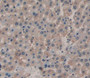 Interleukin 6 Receptor (IL6R) Polyclonal Antibody, Cat#CAU25250