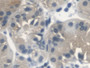 DAB staining on fromalin fixed paraffin- embedded Kidney tissue)