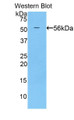 Western Blot; Sample: Recombinant protein.