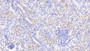 DAB staining on IHC-P; Samples: Human Kidney Tissue;  Primary Ab: 20μg/ml Rabbit Anti-Human UPP1 Antibody Second Ab: 2µg/mL HRP-Linked Caprine Anti-Rabbit IgG Polyclonal Antibody 