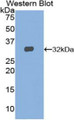 Western Blot; Sample: Recombinant protein.