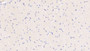 DAB staining on IHC-P; Samples: Bovine Esophagus Tissue;  Primary Ab: 20µg/ml Rabbit Anti-Bovine S100A8 Antibody Second Ab: 2µg/mL HRP-Linked Caprine Anti-Rabbit IgG Polyclonal Antibody 