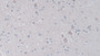 DAB staining on IHC-P; Samples: Human Cerebrum Tissue; Primary Ab: 30µg/ml Rabbit Anti-Human JAM2 Antibody Second Ab: 2µg/mL HRP-Linked Caprine Anti-Rabbit IgG Polyclonal Antibody