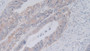 DAB staining on fromalin fixed paraffin-embedded Lung tissue)