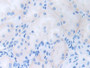 DAB staining on IHC-P; Samples: Human Kidney Tissue;  Primary Ab: 10µg/ml Rabbit Anti-Human CDCP1 An