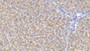 DAB staining on IHC-P; Samples: Porcine Liver Tissue; Primary Ab: 30µg/ml Rabbit Anti-Porcine INHbB Antibody Second Ab: 2µg/mL HRP-Linked Caprine Anti-Rabbit IgG Polyclonal Antibody