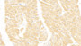DABstainingonIHC-P.Samples:HumanTissue)