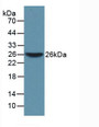 Western Blot; Sample: Recombinant WARS, Mouse.