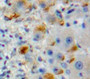 Used in DAB staining on fromalin fixed paraffin-embedded Liver tissue