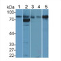 Western Blot; Sample: Lane1: Human Lung lysate; Lane2: Human Placenta lysate; Lane3: Hela cell lysate; Lane4: HepG2 cell lysate; Lane5: A431 cell lysate; Primary Ab: 5μg/ml Rabbit Anti-Human BCAM Antibody; Second Ab: 0.2µg/mL HRP-Linked Caprine Anti-Rabbit IgG Polyclonal Antibody;
