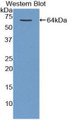 Western Blot; Sample: Recombinant protein.