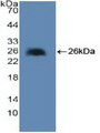 Western Blot; Sample: Recombinant cPLA2, Human.