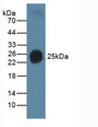 Western Blot; Sample: Human Serum.