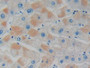 DAB staining on IHC-P; Samples: Human Liver Tissue.