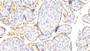 DAB staining on IHC-P; Samples: Human Placenta Tissue; Primary Ab: 20μg/ml Rabbit Anti-Human NEU Antibody Second Ab: 2µg/mL HRP-Linked Caprine Anti-Rabbit IgG Polyclonal Antibody