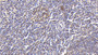 DAB staining on IHC-P; Samples: Human Spleen Tissue; Primary Ab: 30µg/ml Rabbit Anti-Human GROb Antibody Second Ab: 2µg/mL HRP-Linked Caprine Anti-Rabbit IgG Polyclonal Antibody