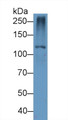Western Blot; Sample: Mouse Liver lysate; Primary Ab: 1µg/ml Rabbit Anti-Mouse Tyk2 Antibody Second Ab: 0.2µg/mL HRP-Linked Caprine Anti-Rabbit IgG Polyclonal Antibody