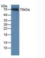 Western Blot; Sample: Recombinant ITGb2, Human.