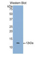 Western Blot; Sample: Recombinant protein.