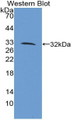 Western Blot; Sample: Recombinant protein.