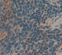 Killer Cell Immunoglobulin Like Receptor 2DS4 (KIR2DS4) Polyclonal Antibody, Cat#CAU25713