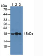 Western Blot; Sample: Lane1: Mouse Heart Tissue; Lane2: Rat Heart Tissue; Lane3: Human Hela Cells.